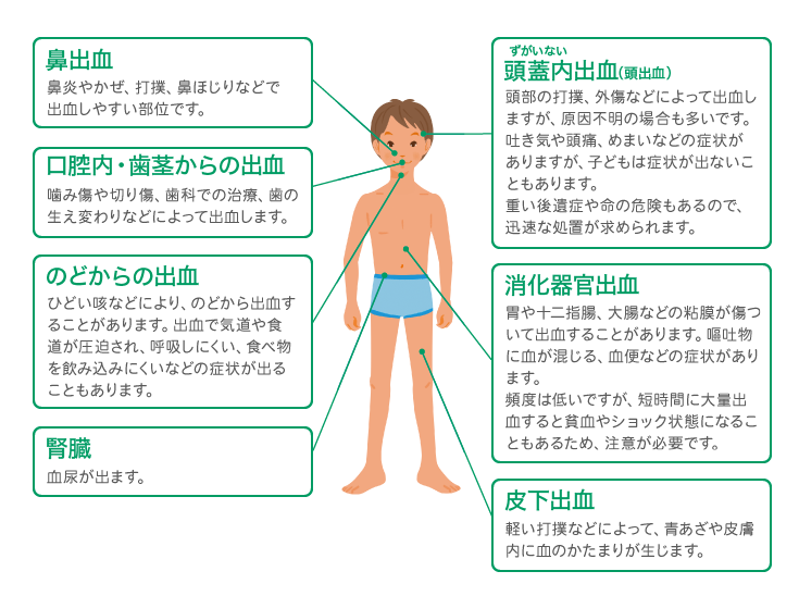 その他の起こりうる出血